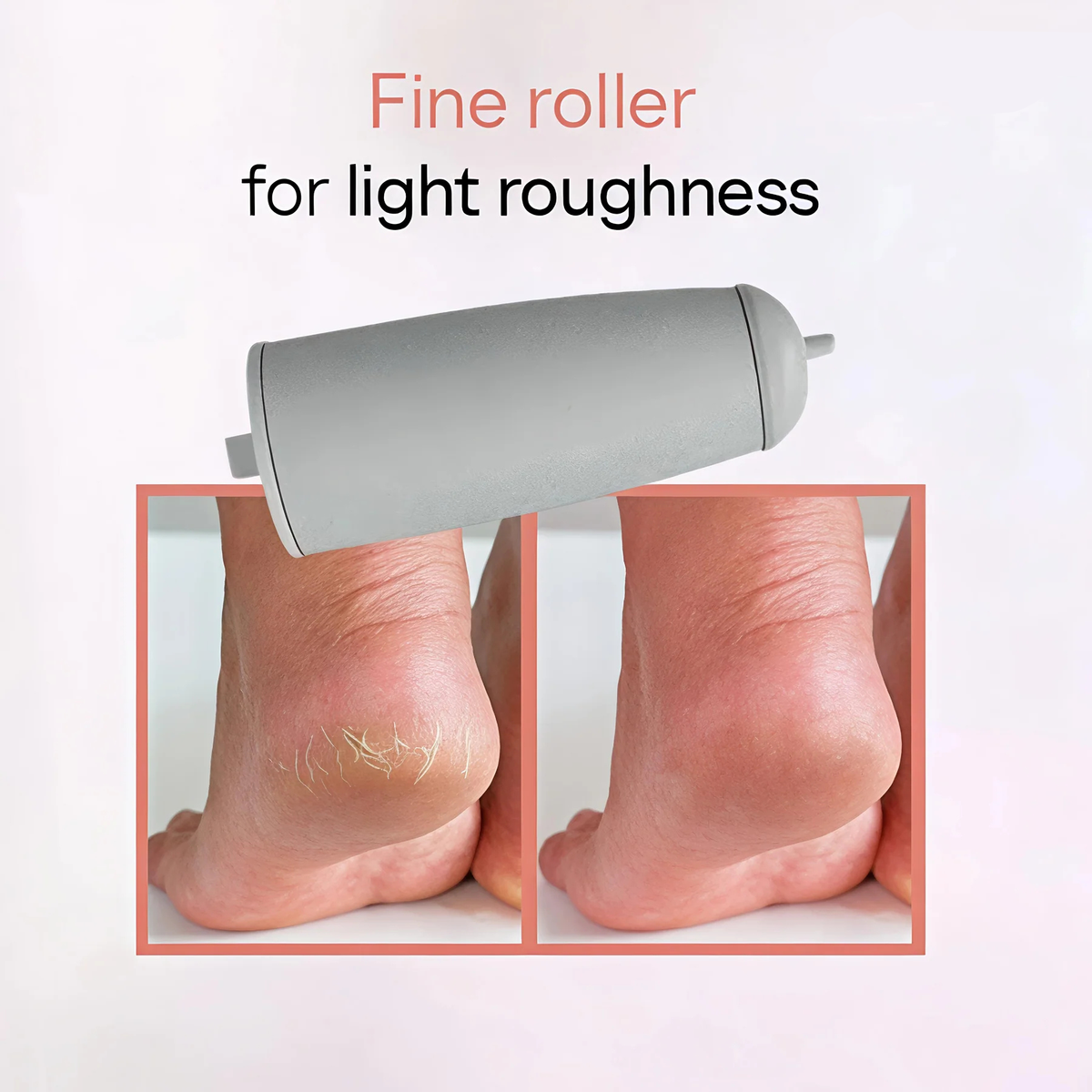 Electronic Cordless Pedicure Callus Dead Skin Remover Polishing Tool